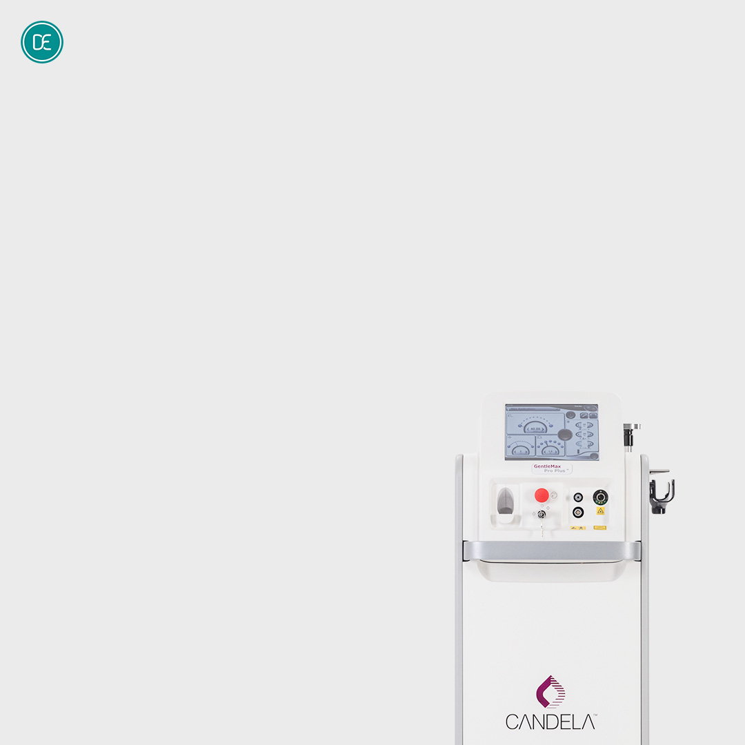 레이저 제모 | 젠틀맥스 hover